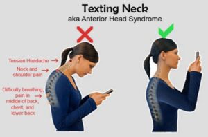 Text Neck from using devices flexing neck