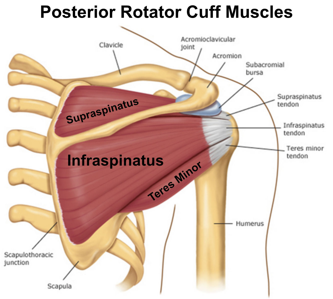 Infraspinatus Syndrome or Tendinitis - Back Care Clinic